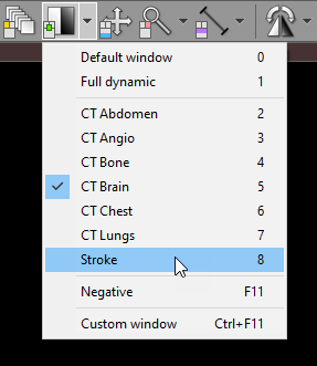 Radiant-Dicom-Viewer-Custom-Window-Presets-Menu