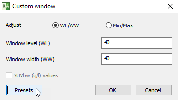 Radiant-Dicom-Viewer-Custom-Window-Presets