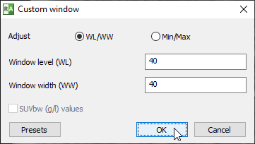 Radiant-Dicom-Viewer-Custom-Window-WW-WL