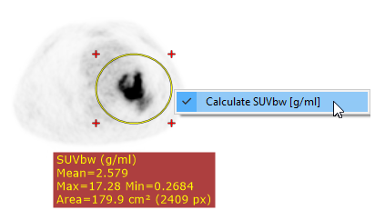 Radiant-Dicom-Viewer-Ellipse-SUV-Switch-Units