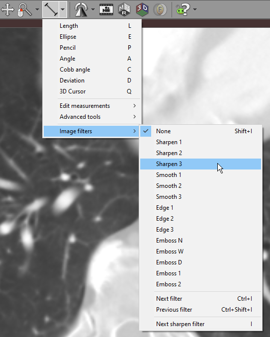 RadiAnt-DICOM-Viewer-Image-filters-menu