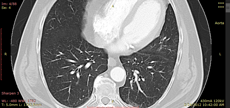 RadiAnt-DICOM-Viewer-Image-filters-sharpen-sample