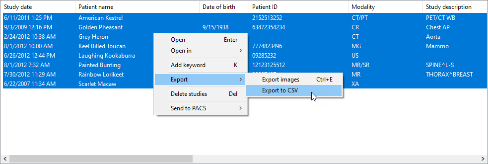 RadiAnt-DICOM-Viewer-Local-Archive-Export-CSV-Menu