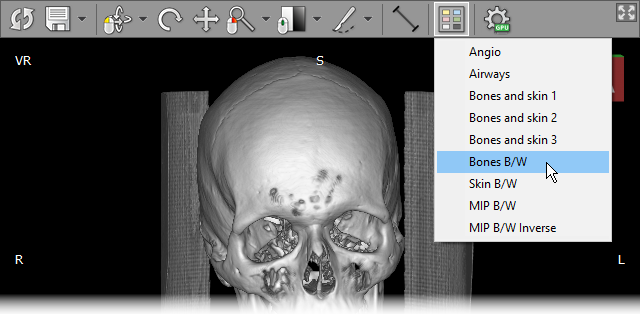 RadiAnt-DICOM-Viewer-STL-Export-Presets