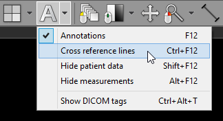 RadiAnt_DICOM_Viewer_Annotations_Cross_Reference_DropDownMenu