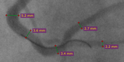 The distance is measured at the detector plane.