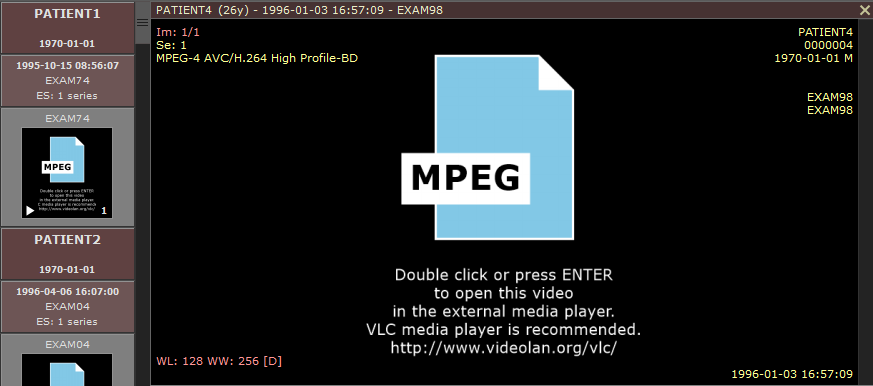 RadiAnt_DICOM_Viewer_MPEG2_MPEG4_Video_Screen