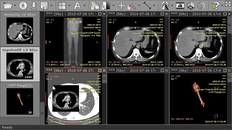 RadiAnt_DICOM_Viewer_Split_Screen_Workspace