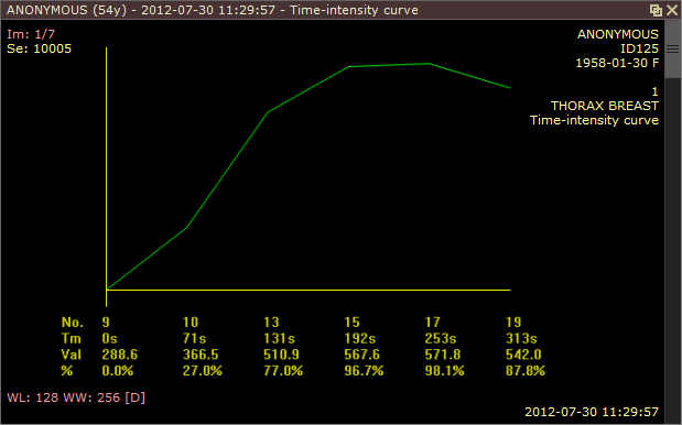 RadiAnt_DICOM_Viewer_Time_Intensity_Curves_Generated_Curve