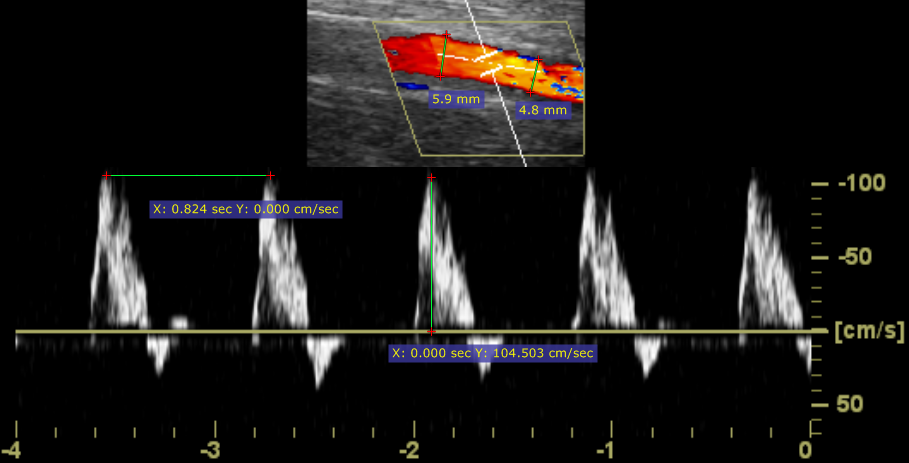 RadiAnt_DICOM_Viewer_Ultrasound_Regions_Measurements