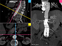 Blog image - RadiAnt DICOM Viewer 4.0.2