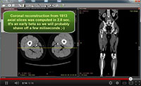 Blog image - RadiAnt DICOM Viewer Development Update