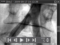 Blog image - RadiAnt DICOM Viewer 1.5.10 BETA