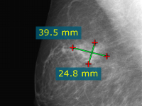 Blog image - RadiAnt DICOM Viewer 1.9.10