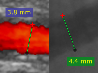 Blog image - RadiAnt DICOM Viewer 1.9.4