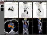 Blog image - RadiAnt DICOM Viewer Development Update