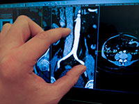 Blog image - RadiAnt DICOM Viewer 1.5.1 BETA