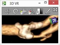 Blog image - RadiAnt DICOM Viewer 2.7.8 BETA