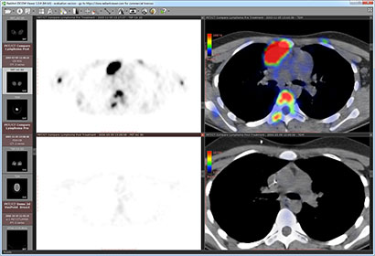 radiant dicom viewer cracked 64