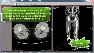 RadiAnt DICOM Viewer MPR preview