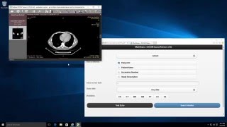 RadiAnt DICOM Viewer with Orthanc Server