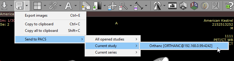 RadiAnt-DICOM-Viewer-2D-Viewer-Send-To-PACS