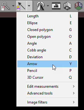 Radiant-Dicom-Viewer-Arrow-Menu