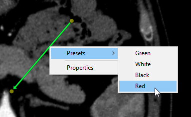 Radiant-Dicom-Viewer-Arrow-Presets-Apply-New