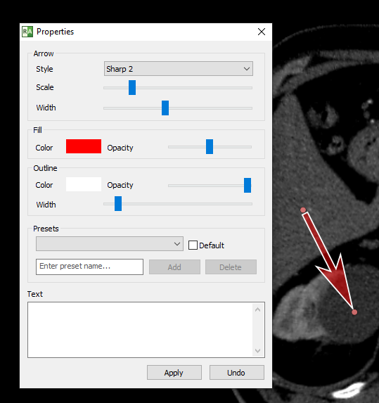 Radiant-Dicom-Viewer-Arrow-Properties-Edit