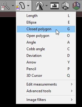 Radiant-Dicom-Viewer-Closed-Polygon-Menu