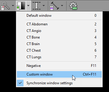 Radiant-Dicom-Viewer-Custom-Window-3DMPR-Menu