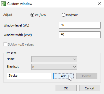 Radiant-Dicom-Viewer-Custom-Window-Presets-Add