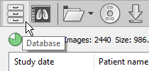 RadiAnt-DICOM-Viewer-Local-Archive-Database-Button