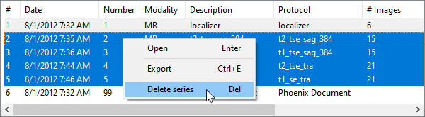 RadiAnt-DICOM-Viewer-Local-Archive-Delete-Series-Menu