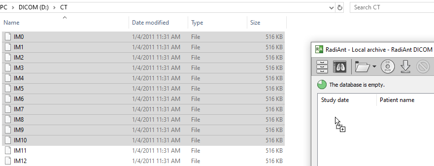 RadiAnt-DICOM-Viewer-Local-Archive-Drag-And-Drop-DICOM-Files