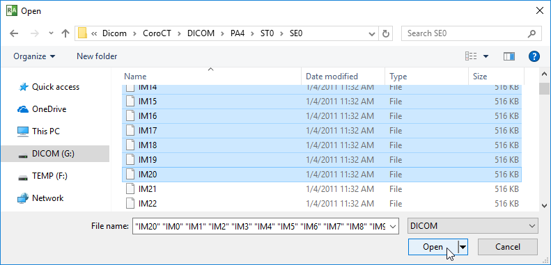 RadiAnt-DICOM-Viewer-Local-Archive-Import-DICOM-File-Dialog