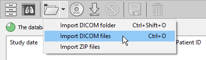 RadiAnt-DICOM-Viewer-Local-Archive-Import-DICOM-Files-Menu