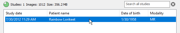 RadiAnt-DICOM-Viewer-Local-Archive-Imported-Study