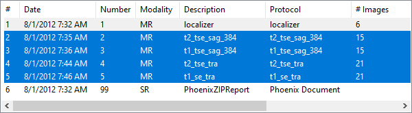 RadiAnt-DICOM-Viewer-Local-Archive-Selected-Series