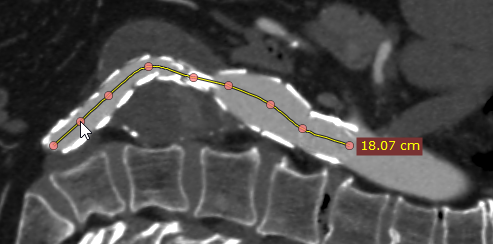 Radiant-Dicom-Viewer-Open-Polygon-Add-Node