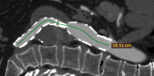 Radiant-Dicom-Viewer-Open-Polygon-Sample