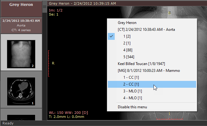 RadiAnt-DICOM-Viewer-Series-Selection-Menu