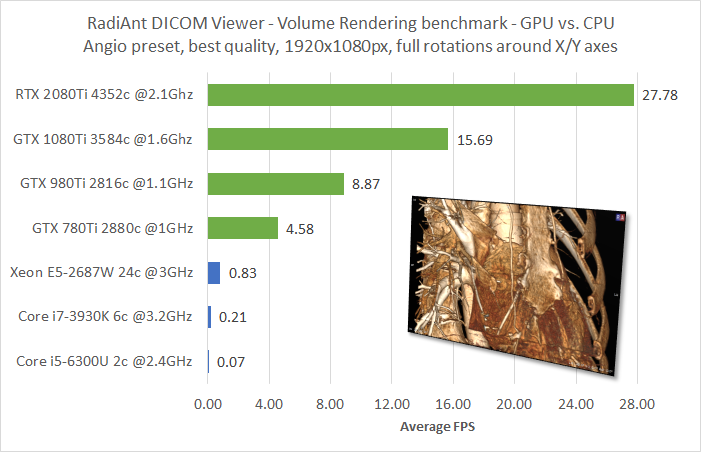 radiant-dicom-viewer-volume-rendering-be