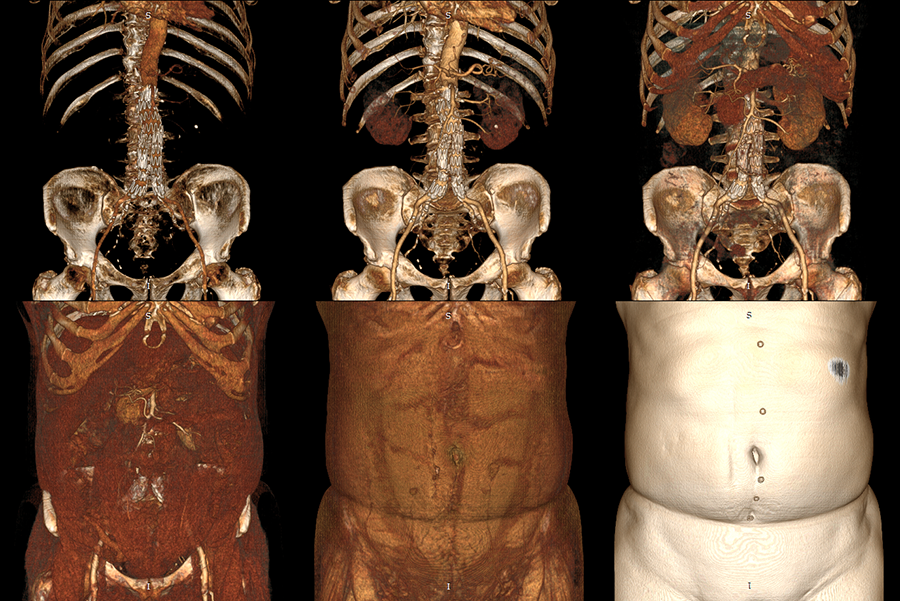 RadiAnt_DICOM_Viewer_3D_Volume_Rendering_WindowAdjustments