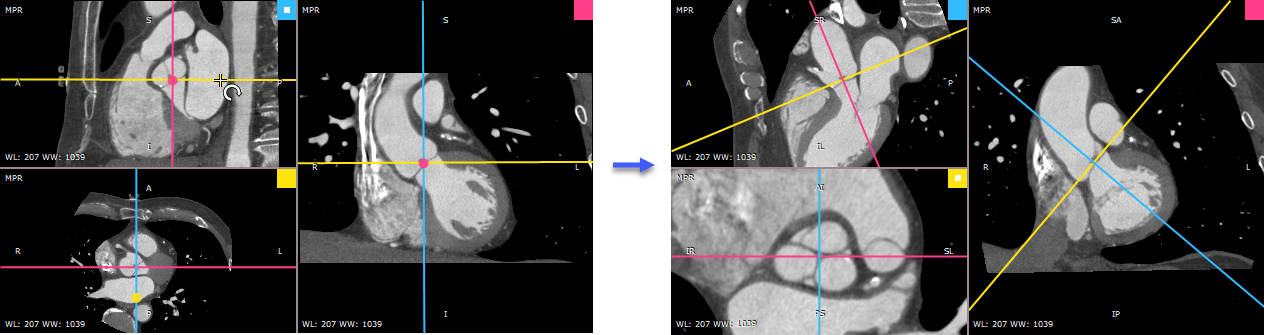 RadiAnt_DICOM_Viewer_3DMPR_Axes_Rotate