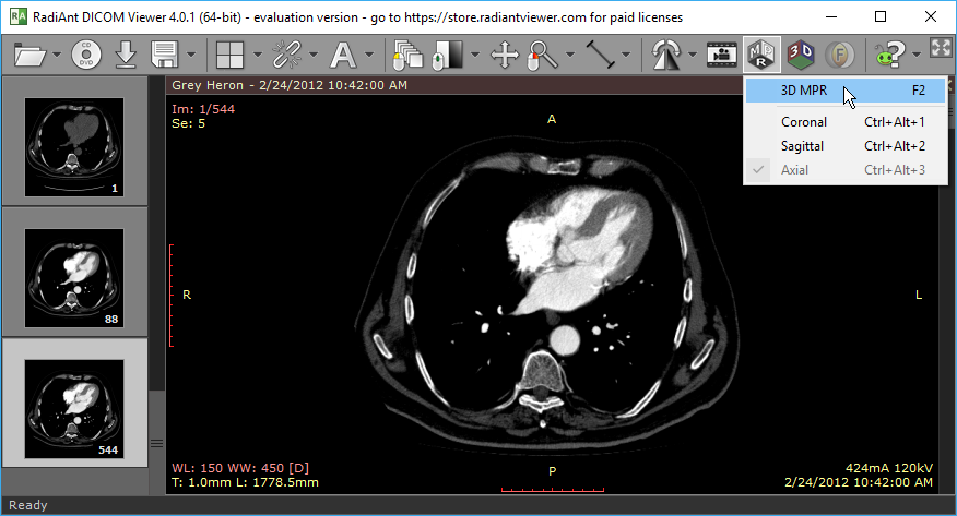 RadiAnt_DICOM_Viewer_3DMPR_Source_Series