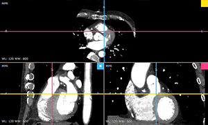 RadiAnt_DICOM_Viewer_3DMPR_ViewportLayoutRows12