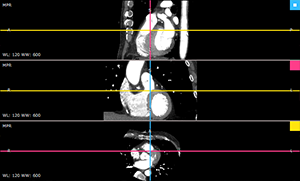 RadiAnt_DICOM_Viewer_3DMPR_ViewportLayoutRows3