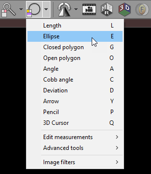 RadiAnt_DICOM_Viewer_Adjust_Measurements_DropDownMenu_Ellipse