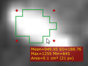 RadiAnt_DICOM_Viewer_Adjust_Measurements_Ellipse_Actual_Pixels